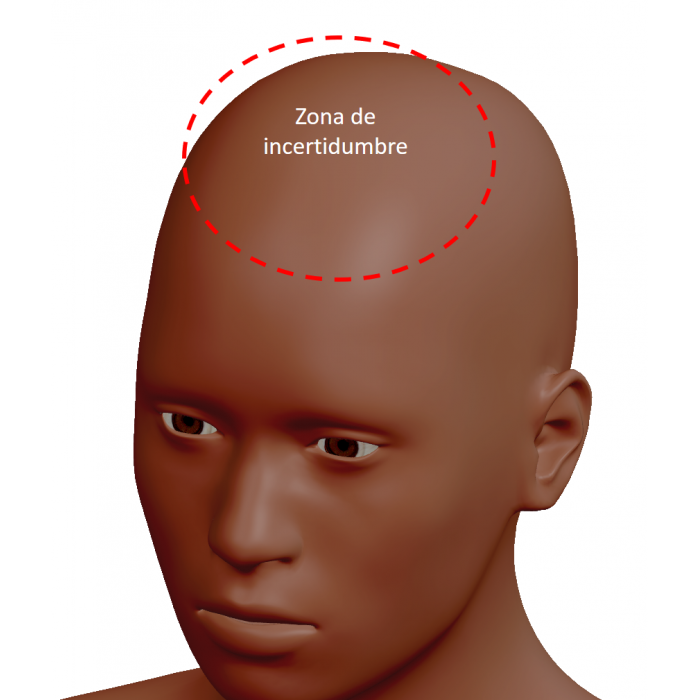 Uncertainty area of the upper contour of the head in an oblique view image