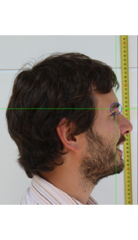 Mid-supraorbital marking on a photograph in lateral view (center) 