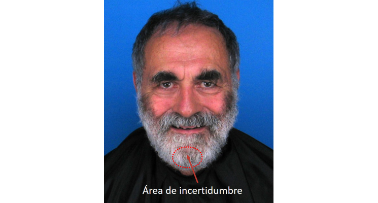 Sujeto con barba poblada que imposibilita la visión del mentón