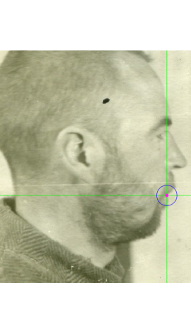 Stomion marking on a photograph in lateral view (center)