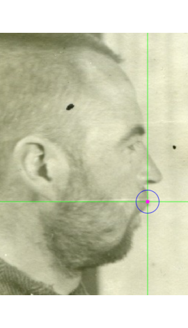 Labiale superius marking on a photograph in ateral view (center)