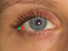 Exocanthion marcado correctamente (punto verde) y erróneamente (punto rojo)