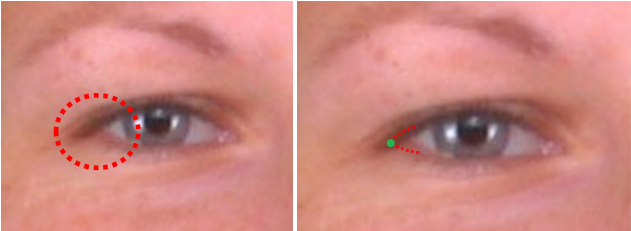 Imagen de un ojo donde la pestaña cubre el canto lateral (izquierda). Exocanthion derecho estimado (derecha)