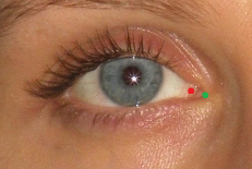 Marcado erróneo de endocanthion (punto rojo) y marcado correcto (punto verde)