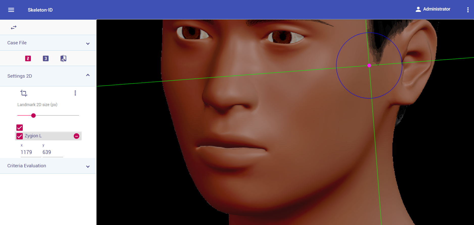 Zygion (left) in oblique view. Approximation in the image